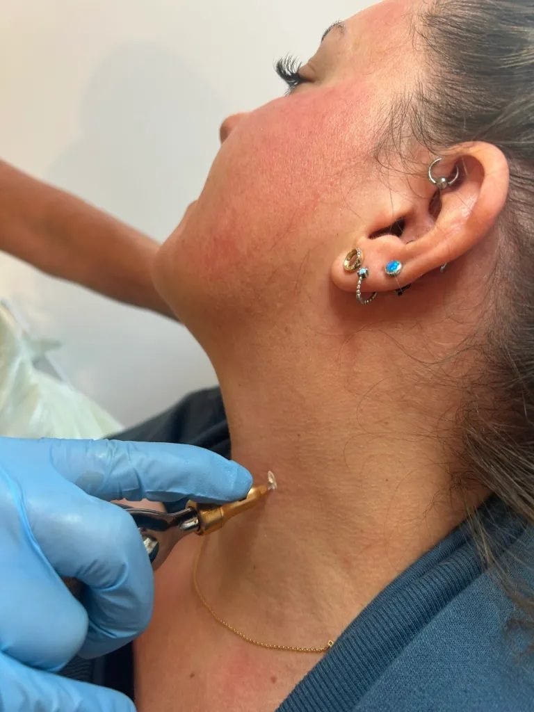 Essential Considerations People Tend to Overlook When Seeking an Aesthetic Clinic Sheffield - 100% Free Guest Posting Website